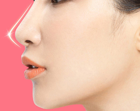 软骨隆鼻的风险有哪些?一文让你了解!