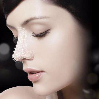 自体软骨隆鼻需要多长时间恢复?超全避坑指南奉上!